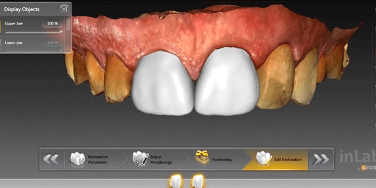 Achieve esthetic restorations with strong bonds