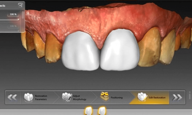 Achieve esthetic restorations with strong bonds