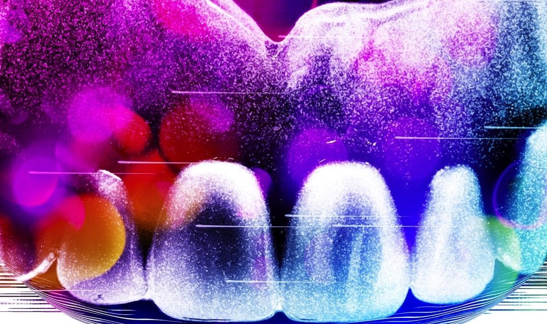 Why I made the switch to digital dentures