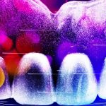 Why I made the switch to digital dentures