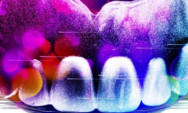 Why I made the switch to digital dentures