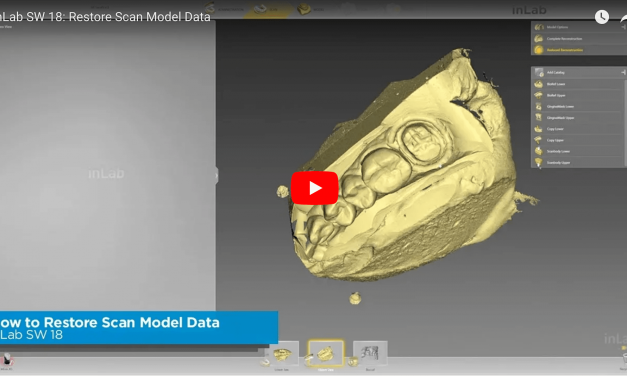 inLab SW 18: Restore Scan Model Data