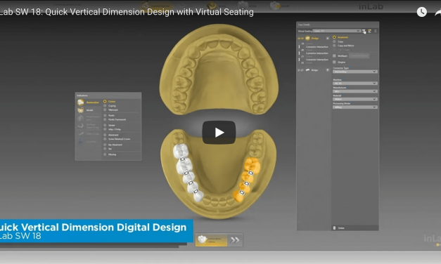 inLab SW 18: Quick Vertical Dimension Design with Virtual Seating