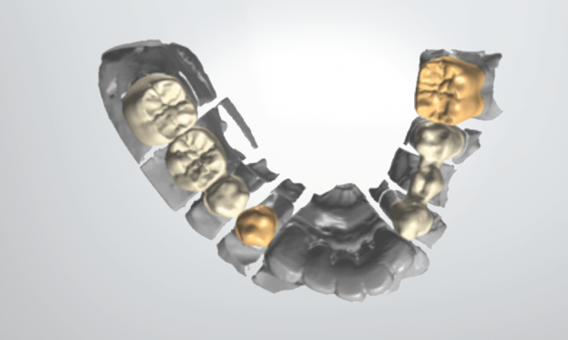 Clinical Update: The new standard for all-ceramic solutions