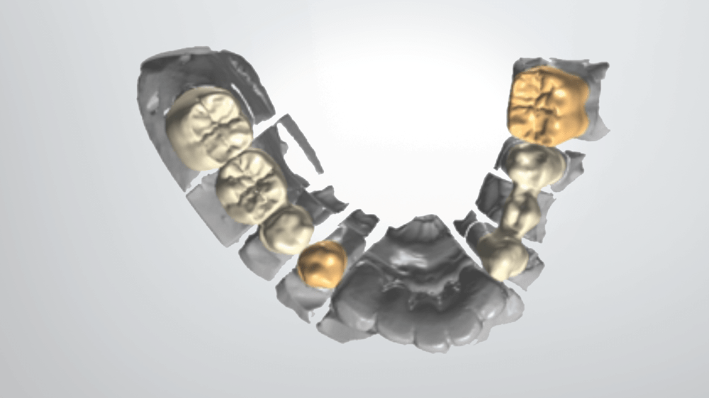 Clinical Update: The new standard for all-ceramic solutions