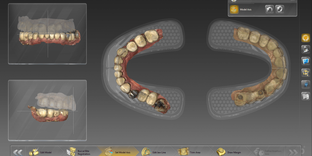 Dentsply Sirona’s inLab® System: Versatile Digital Solution