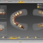 Dentsply Sirona’s inLab® System: Versatile Digital Solution