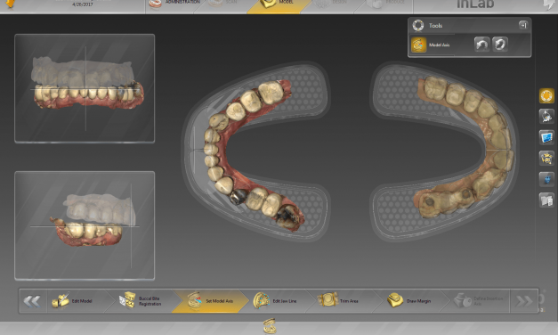 Dentsply Sirona’s inLab® System: Versatile Digital Solution